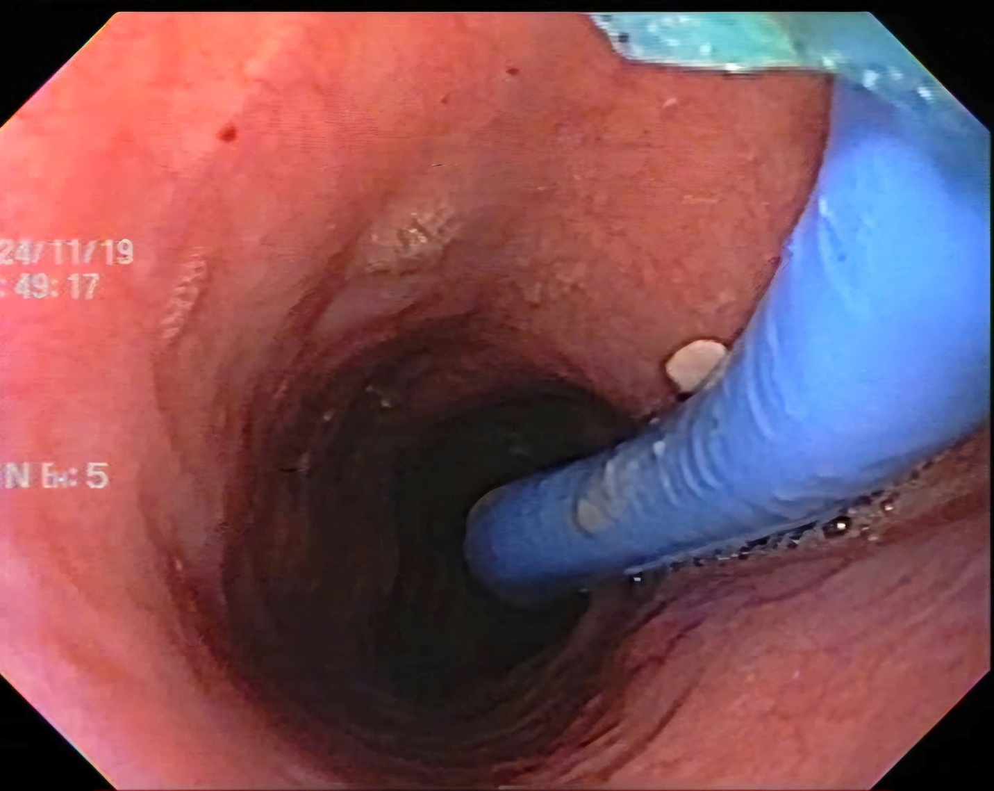 di vat khong the ngo ban chai dang rang trong thuc quan 2